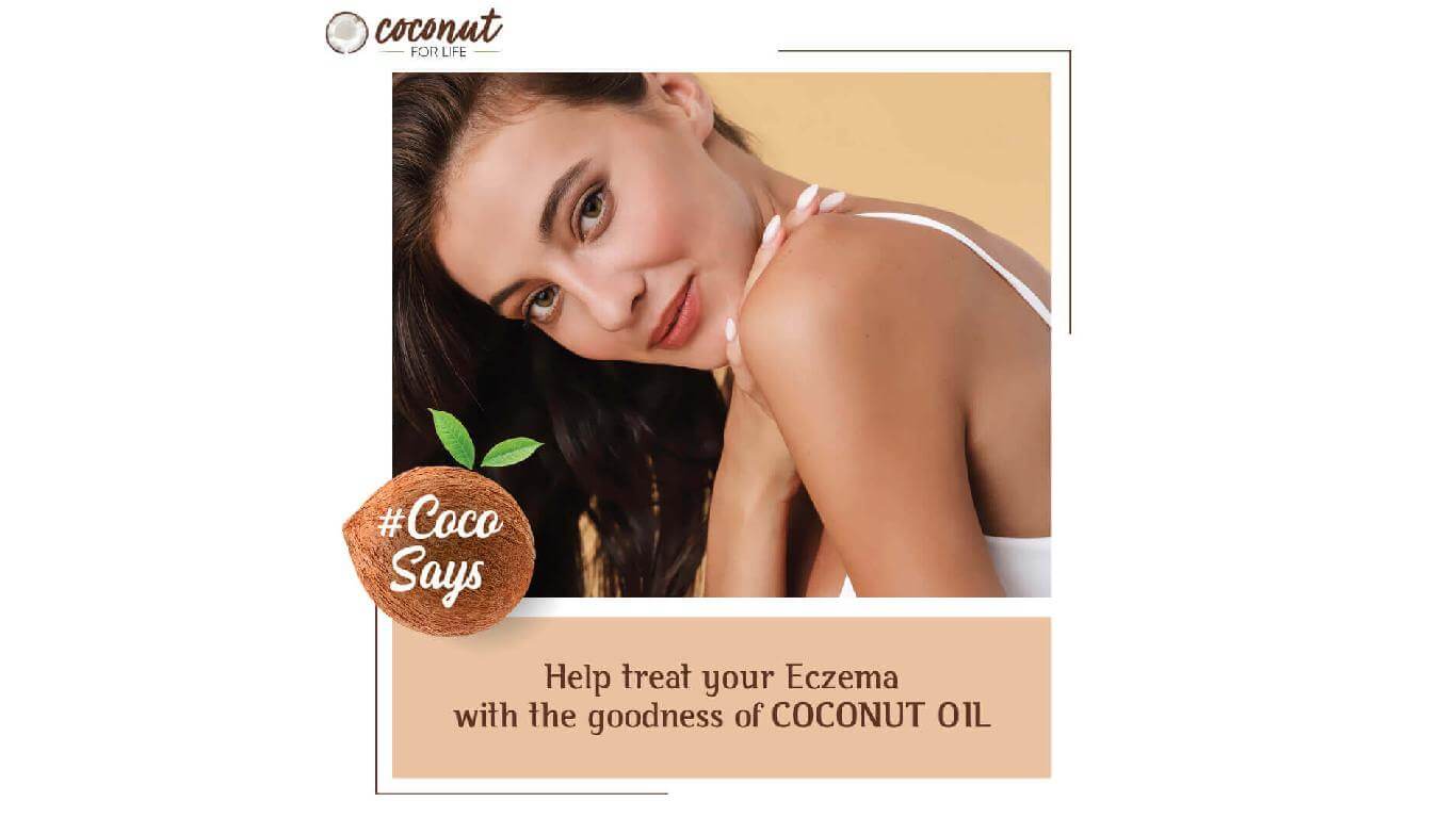 Help treat your Eczema with goodness of COCONUT OIL