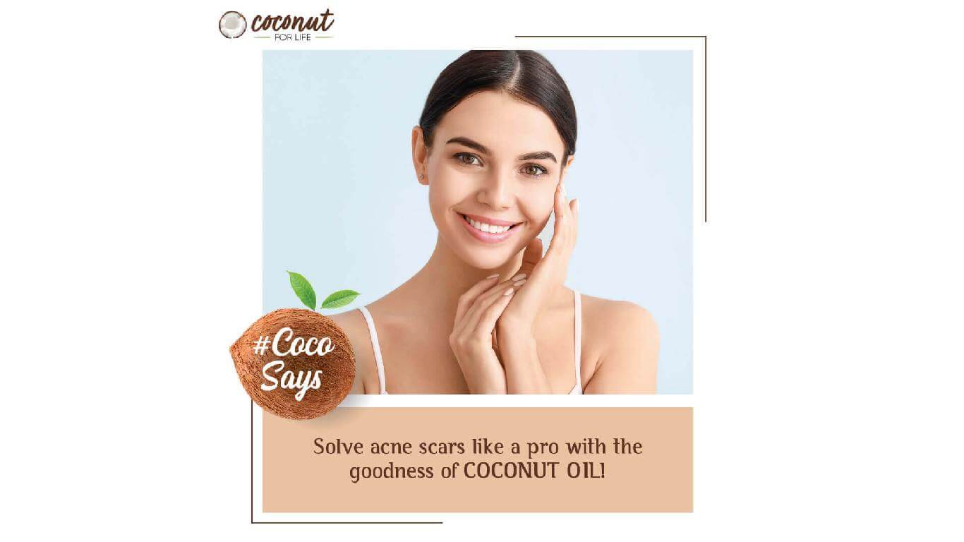 Solve acne scars like a pro with the goodness of COCONUT OIL!