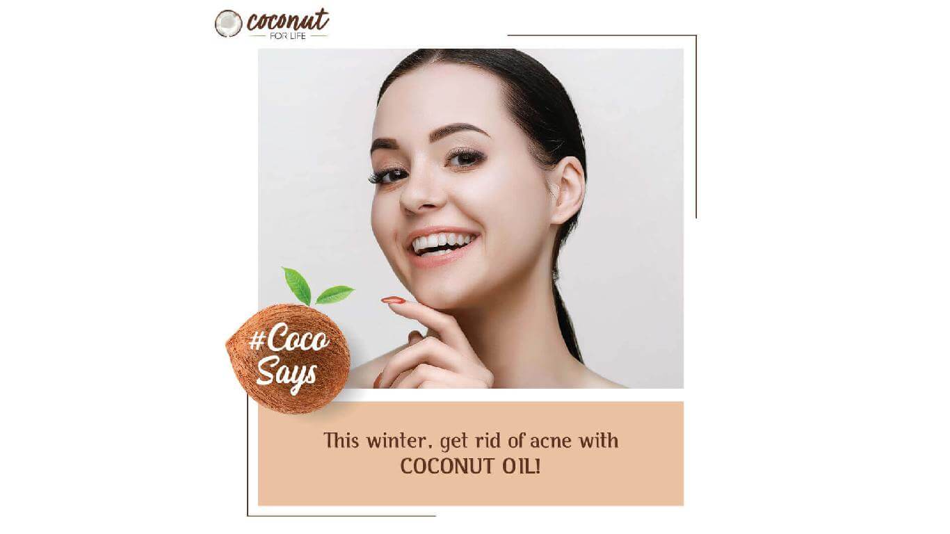 This Winter, get rid of acne with COCONUT OIL!